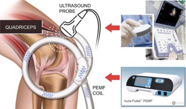 ultrasound of quadriceps